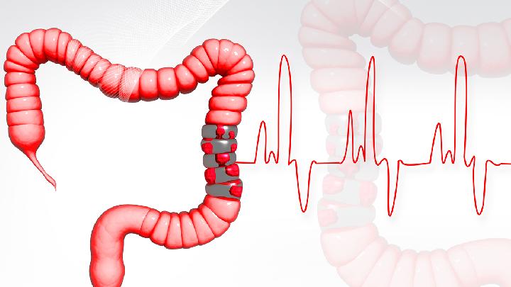 导致直肠癌的因素有哪些？ 直肠癌病变有哪些信号？(图2)